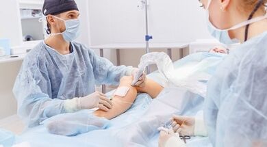 Varicose verse surgery
