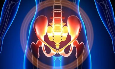 The causes of the varicose veins of the pelvis