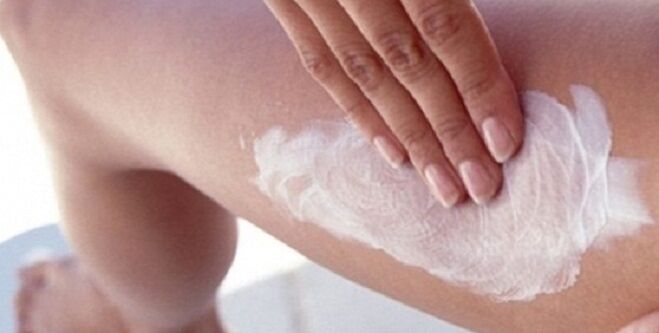 Applying medicinal ointment to the legs for varicose veins
