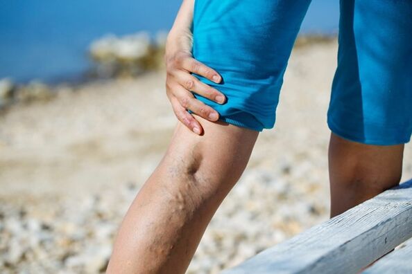 Dull pain in the legs with varicose veins