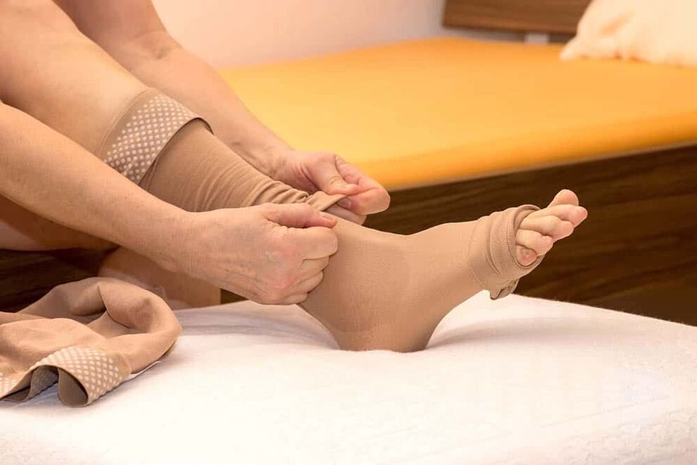 Wearing compression stockings will help alleviate the manifestations of varicose veins. 